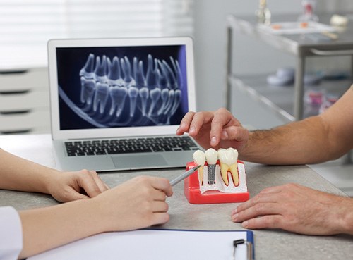 A dental implant consultation