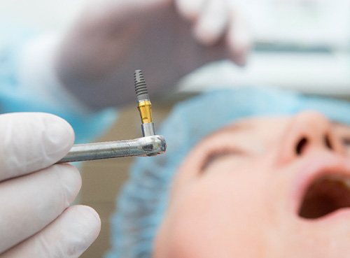 A dental implant surgery