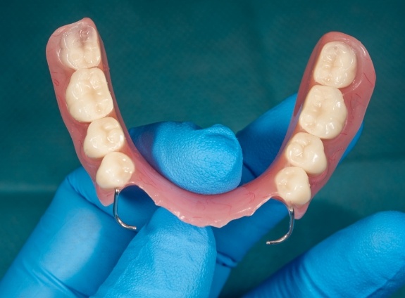 Gloved hand holding a partial denture